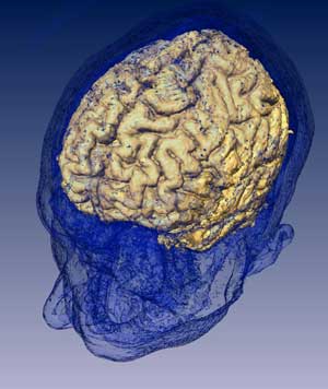Brain